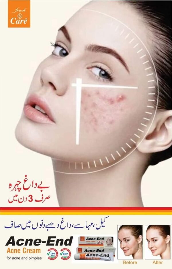 ACNE END CREAM